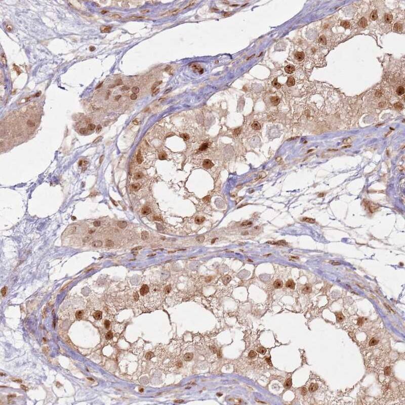 Staining of human testis shows moderate cytoplasmic and nuclear positivity in cells in seminiferous ducts and Leydig cells.