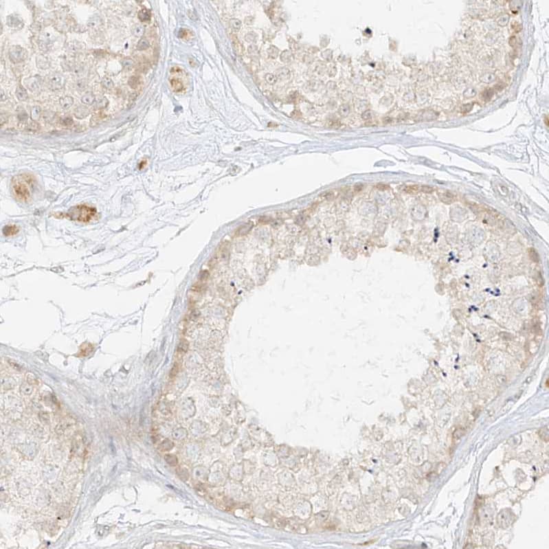Immunohistochemistry-Paraffin lipoyltransferase 1 Antibody - BSA Free