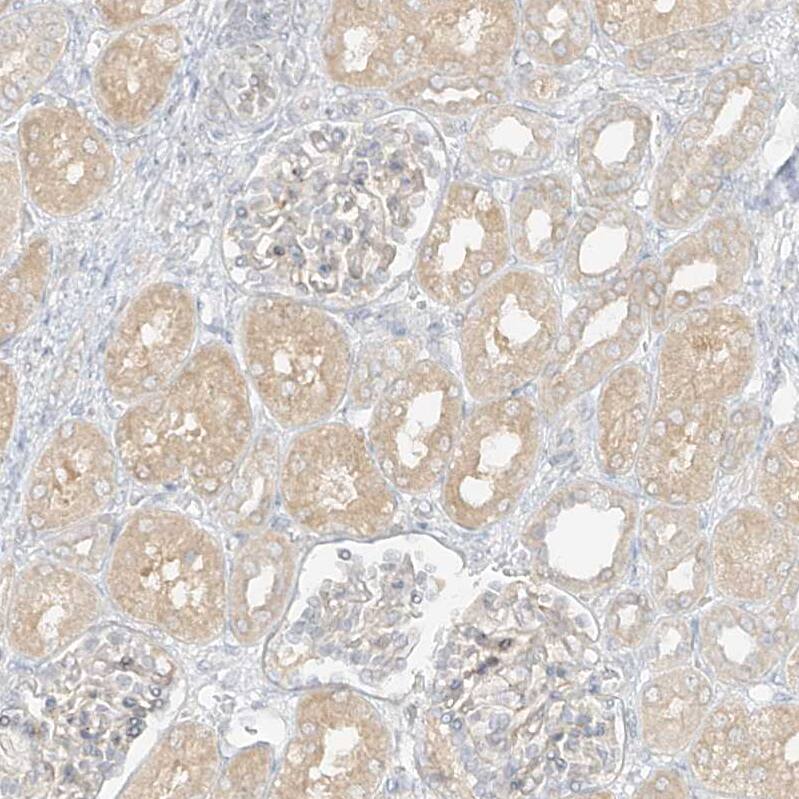 Staining of human kidney shows weak cytoplasmic positivity in cells in tubules.