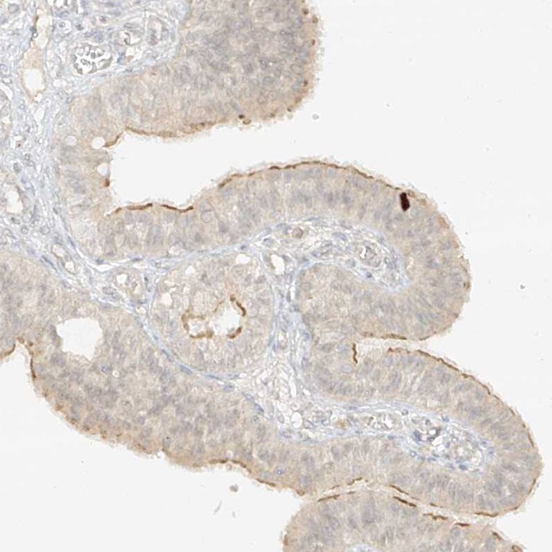 Staining of human fallopian tube shows weak cytoplasmic positivity in glandular cells.