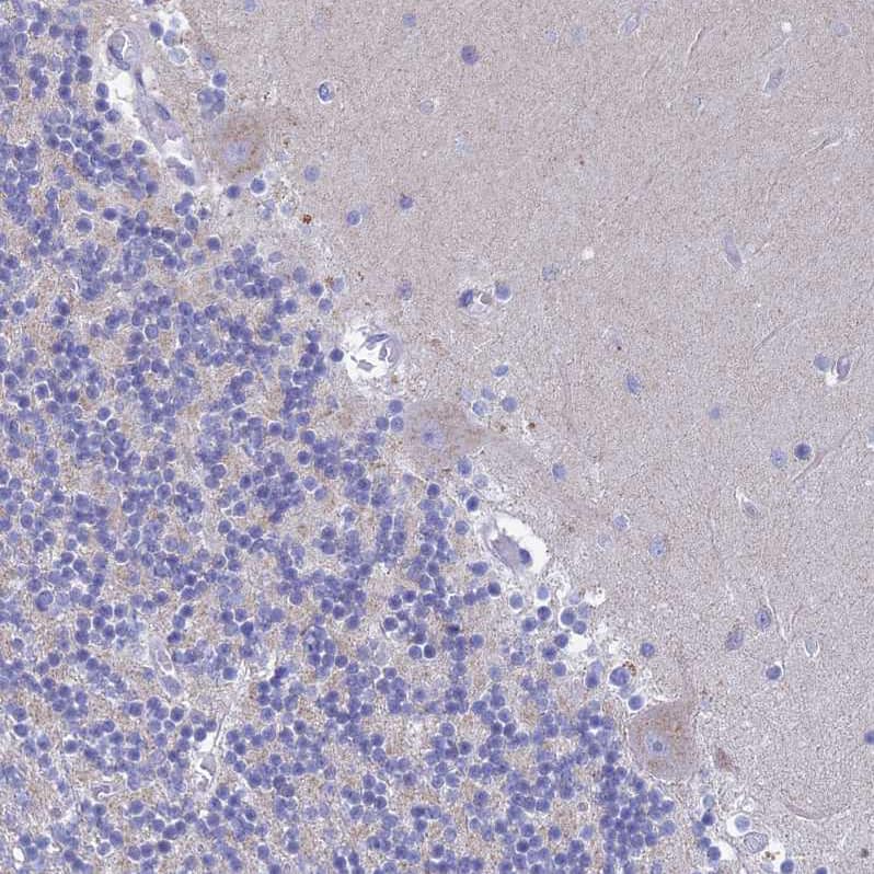 Staining of human cerebellum shows no positivity in Purkinje cells as expected.