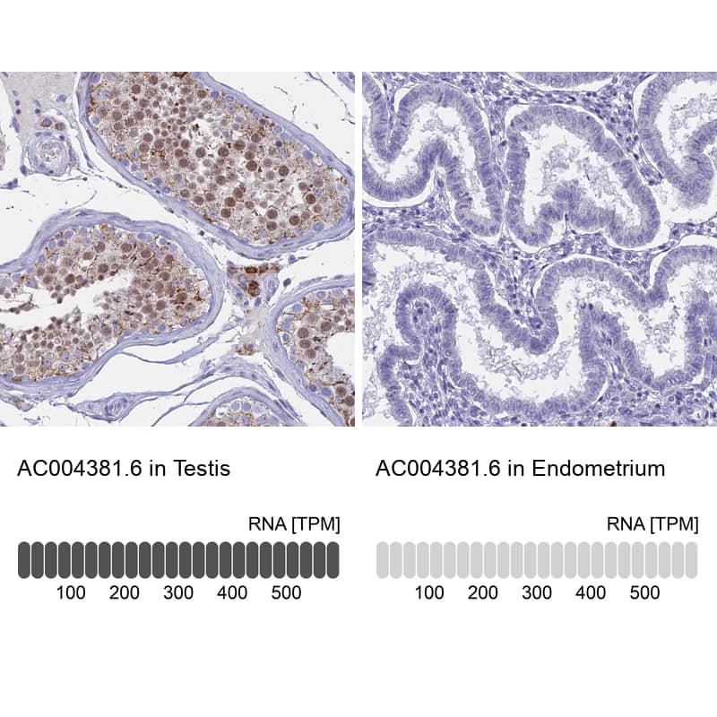 <b>Orthogonal Strategies Validation. </b>Analysis in human testis and endometrium tissues using Anti-AC004381.6 antibody. Corresponding AC004381.6 RNA-seq data are presented for the same tissues.