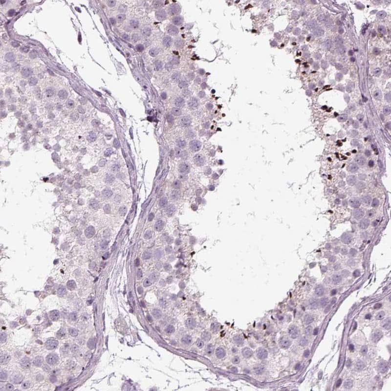 Immunohistochemistry-Paraffin LRRC44 Antibody - BSA Free
