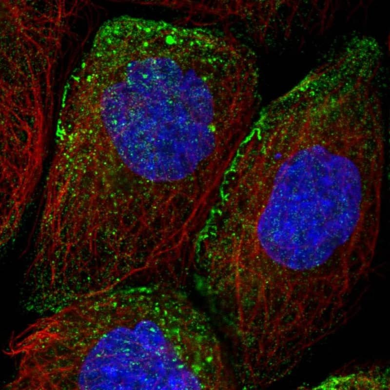 Staining of human cell line A-431 shows localization to vesicles.