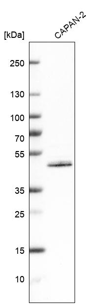 Analysis in human cell line CAPAN-2.