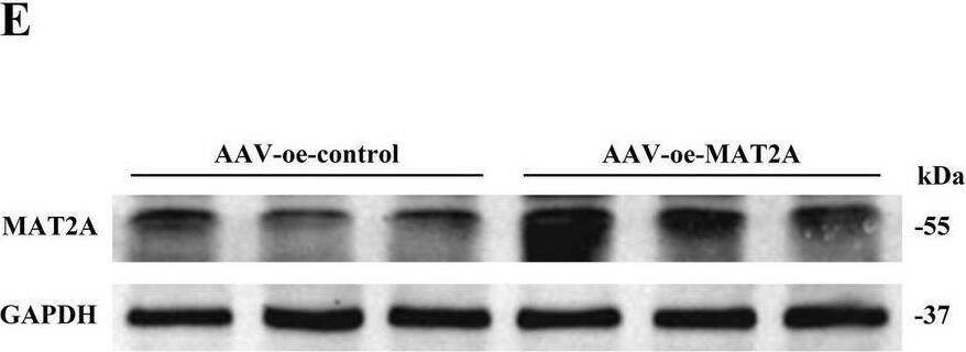 Effects of MAT2A on learning and memory in 5 × FAD mice. (A,B) Expression of MAT2A protein in the hippocampus of 5 × FAD mice (n = 5). (C) Flow chart of injection of overexpressed MAT2A virus and subsequent neurobehavioral experiments. (D) Schematic representation of stereoscopic fluorescence diffusion in 5 × FAD mice hippocampal brain (scale bar = 500 μm). (E,F) Expression level of MAT2A protein after overexpression of MAT2A in 5 × FAD mice (n = 5). (G) Expression level of MAT2A mRNA after overexpression of MAT2A in 5 × FAD mice (n = 3). (H,I) NOR was performed to assess recognition memory after overexpression of MAT2A in 5 × FAD mice (n = 10). (J–L) YM was performed to assess spatial memory after overexpression of MAT2A in 5 × FAD mice (n = 10). (M–P) MWM was performed to assess spatial memory after overexpression of MAT2A in 5 × FAD mice (n = 10). Data are shown as the mean +/- SD. *p < 0.05, **p < 0.01, and ***p < 0.001. Image collected and cropped by CiteAb from the following open publication (//pubmed.ncbi.nlm.nih.gov/40308894), licensed under a CC-BY license. Not internally tested by Novus Biologicals.
