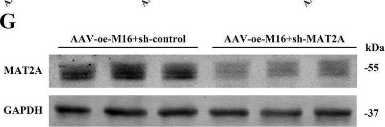 Effects of METTL16 regulation of MAT2A on learning and memory in 5 × FAD mice. (A,B) Expression of MAT2A protein in the hippocampus of 5 × FAD mice after METTL16 overexpression (n = 5). (C) Expression of MAT2A mRNA in the hippocampus of 5 × FAD mice after METTL16 overexpression (n = 3). (D) m6A methylation level of MAT2A mRNA in the hippocampus of 5 × FAD mice after METTL16 overexpression (n = 3). (E) Flow chart illustrating injection of overexpressed METTL16, knockdown MAT2A virus, and subsequent neurobehavioral experiments. (F) Schematic representation of stereoscopic fluorescence diffusion in 5 × FAD mice hippocampal brain (scale bar = 500 μm). (G,H) Expression level of MAT2A protein after overexpression of METTL16 and knockdown of MAT2A in 5 × FAD mice (n = 4). (I) Expression level of MAT2A mRNA after overexpression of METTL16 and knockdown of MAT2A in 5 × FAD mice (n = 3). (J,K) NOR was performed to assess recognition memory after overexpression of METTL16 and knockdown of MAT2A in 5 × FAD mice (n = 10). (L–N) YM was performed to assess spatial memory after overexpression of METTL16 and knockdown of MAT2A in 5 × FAD mice (n = 10). (O–R) MWM was performed to assess spatial memory after overexpression of METTL16 and knockdown of MAT2A in 5 × FAD mice (n = 10). Data are shown as the mean +/- SD. *p < 0.05, **p < 0.01, and ***p < 0.001. Image collected and cropped by CiteAb from the following open publication (//pubmed.ncbi.nlm.nih.gov/40308894), licensed under a CC-BY license. Not internally tested by Novus Biologicals.