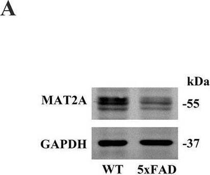 Effects of MAT2A on learning and memory in 5 × FAD mice. (A,B) Expression of MAT2A protein in the hippocampus of 5 × FAD mice (n = 5). (C) Flow chart of injection of overexpressed MAT2A virus and subsequent neurobehavioral experiments. (D) Schematic representation of stereoscopic fluorescence diffusion in 5 × FAD mice hippocampal brain (scale bar = 500 μm). (E,F) Expression level of MAT2A protein after overexpression of MAT2A in 5 × FAD mice (n = 5). (G) Expression level of MAT2A mRNA after overexpression of MAT2A in 5 × FAD mice (n = 3). (H,I) NOR was performed to assess recognition memory after overexpression of MAT2A in 5 × FAD mice (n = 10). (J–L) YM was performed to assess spatial memory after overexpression of MAT2A in 5 × FAD mice (n = 10). (M–P) MWM was performed to assess spatial memory after overexpression of MAT2A in 5 × FAD mice (n = 10). Data are shown as the mean +/- SD. *p < 0.05, **p < 0.01, and ***p < 0.001. Image collected and cropped by CiteAb from the following open publication (//pubmed.ncbi.nlm.nih.gov/40308894), licensed under a CC-BY license. Not internally tested by Novus Biologicals.
