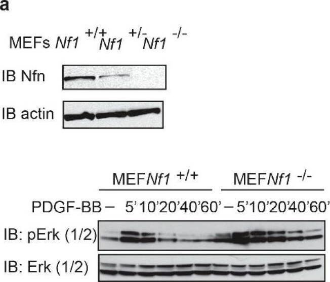 Western Blot Neurofibromin 1 Antibody - BSA Free