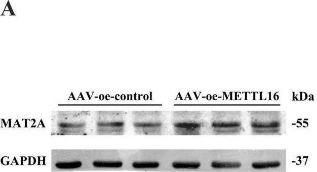 Effects of METTL16 regulation of MAT2A on learning and memory in 5 × FAD mice. (A,B) Expression of MAT2A protein in the hippocampus of 5 × FAD mice after METTL16 overexpression (n = 5). (C) Expression of MAT2A mRNA in the hippocampus of 5 × FAD mice after METTL16 overexpression (n = 3). (D) m6A methylation level of MAT2A mRNA in the hippocampus of 5 × FAD mice after METTL16 overexpression (n = 3). (E) Flow chart illustrating injection of overexpressed METTL16, knockdown MAT2A virus, and subsequent neurobehavioral experiments. (F) Schematic representation of stereoscopic fluorescence diffusion in 5 × FAD mice hippocampal brain (scale bar = 500 μm). (G,H) Expression level of MAT2A protein after overexpression of METTL16 and knockdown of MAT2A in 5 × FAD mice (n = 4). (I) Expression level of MAT2A mRNA after overexpression of METTL16 and knockdown of MAT2A in 5 × FAD mice (n = 3). (J,K) NOR was performed to assess recognition memory after overexpression of METTL16 and knockdown of MAT2A in 5 × FAD mice (n = 10). (L–N) YM was performed to assess spatial memory after overexpression of METTL16 and knockdown of MAT2A in 5 × FAD mice (n = 10). (O–R) MWM was performed to assess spatial memory after overexpression of METTL16 and knockdown of MAT2A in 5 × FAD mice (n = 10). Data are shown as the mean +/- SD. *p < 0.05, **p < 0.01, and ***p < 0.001. Image collected and cropped by CiteAb from the following open publication (//pubmed.ncbi.nlm.nih.gov/40308894), licensed under a CC-BY license. Not internally tested by Novus Biologicals.
