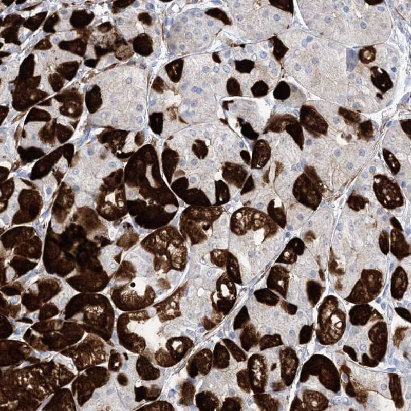Immunohistochemistry-Paraffin Methionyl tRNA synthetase 2 Antibody - BSA Free