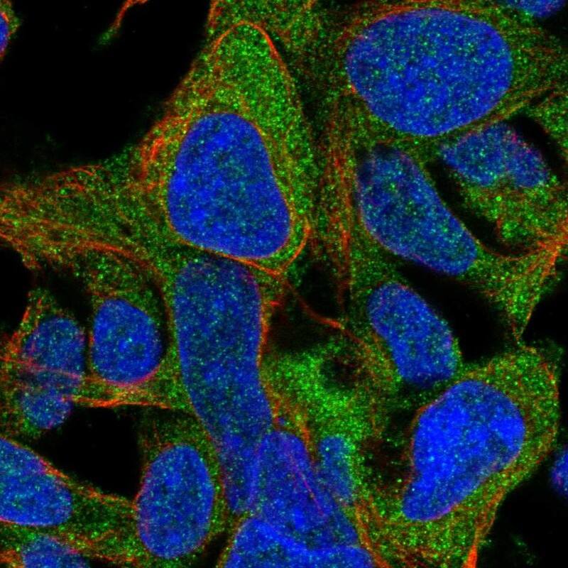 Immunocytochemistry/ Immunofluorescence MGC13138 Antibody - BSA Free