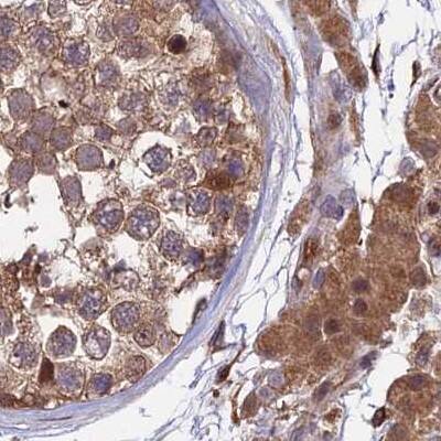 Immunohistochemistry-Paraffin MKKS Antibody - BSA Free