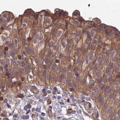 Immunohistochemistry-Paraffin MKKS Antibody - BSA Free