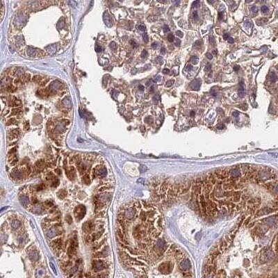 Immunohistochemistry-Paraffin MKKS Antibody - BSA Free