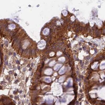 Immunohistochemistry-Paraffin MKKS Antibody - BSA Free