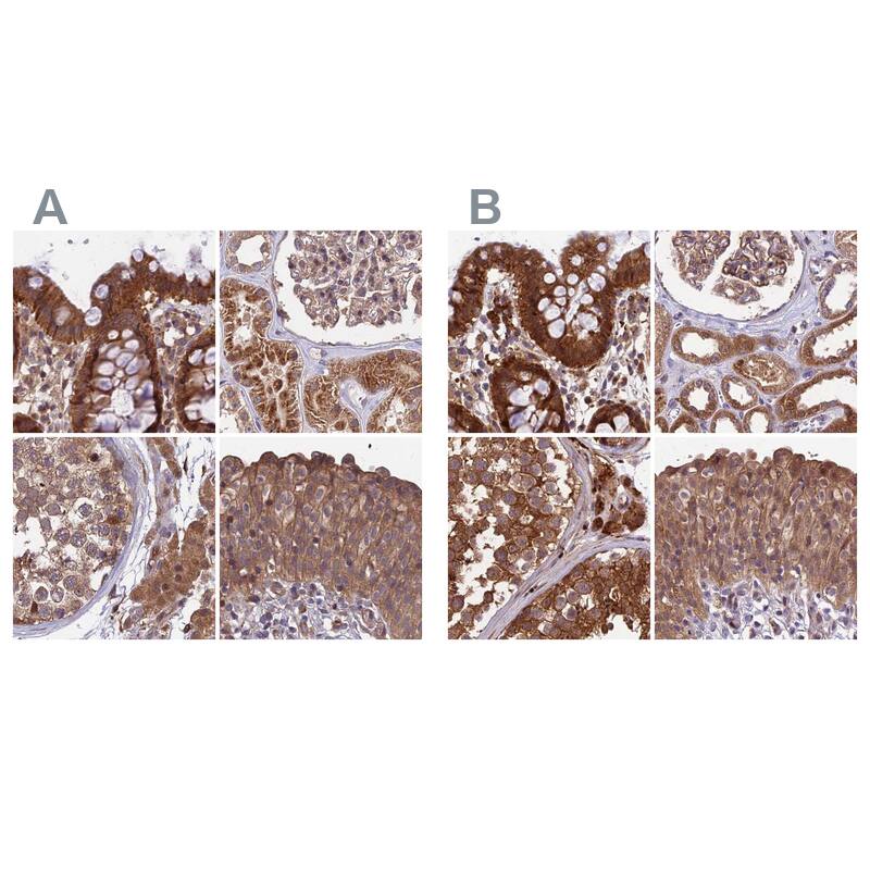 Immunohistochemistry-Paraffin MKKS Antibody - BSA Free