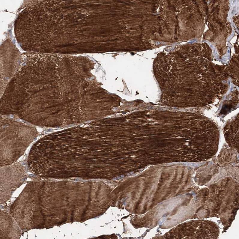Staining of human skeletal muscle shows strong cytoplasmic positivity in myocytes.