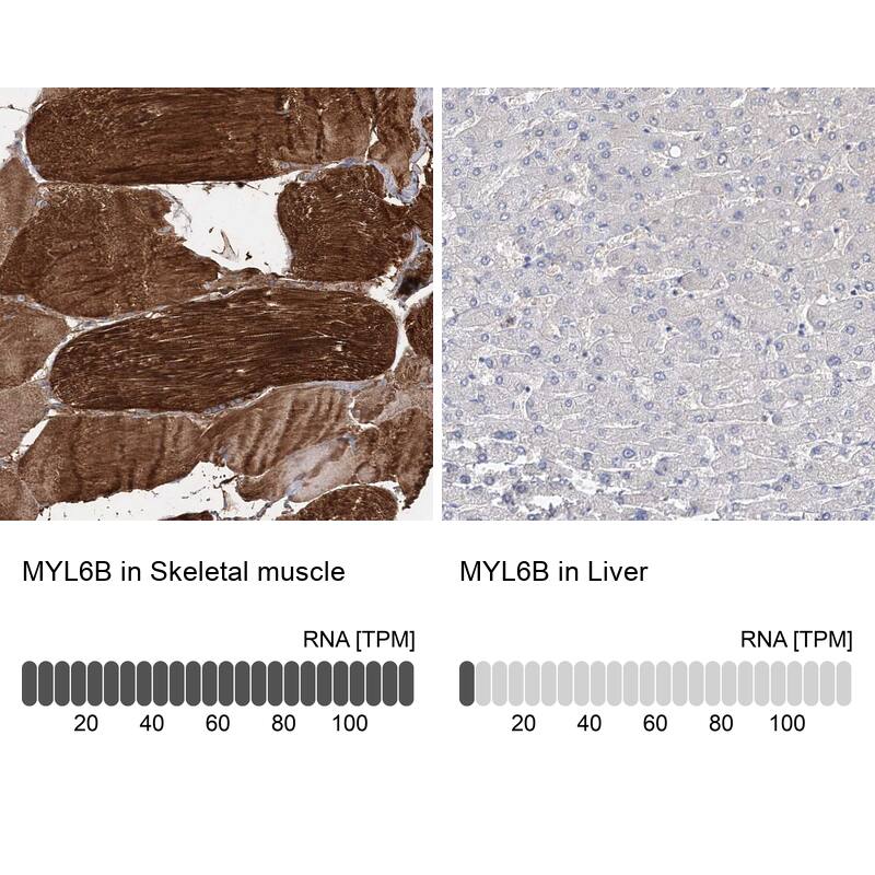 Analysis in human skeletal muscle and liver tissues using NBP1-92124 antibody. Corresponding MYL6B RNA-seq data are presented for the same tissues.