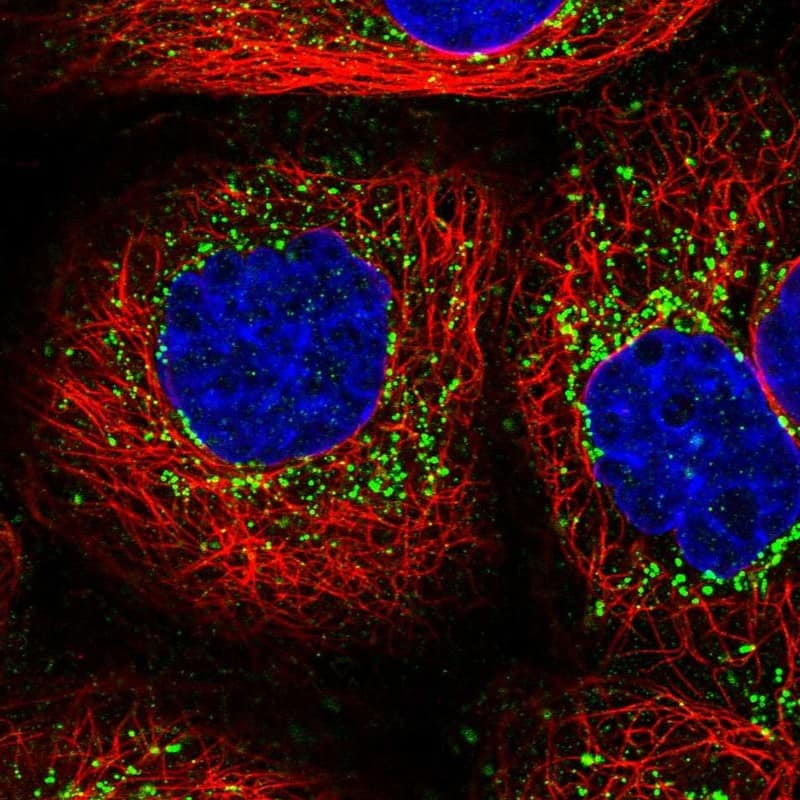 Staining of human cell line A-431 shows localization to vesicles.