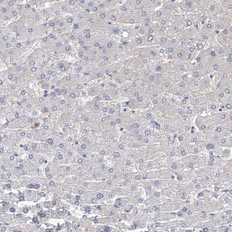 Staining of human liver shows no positivity in hepatocytes as expected.