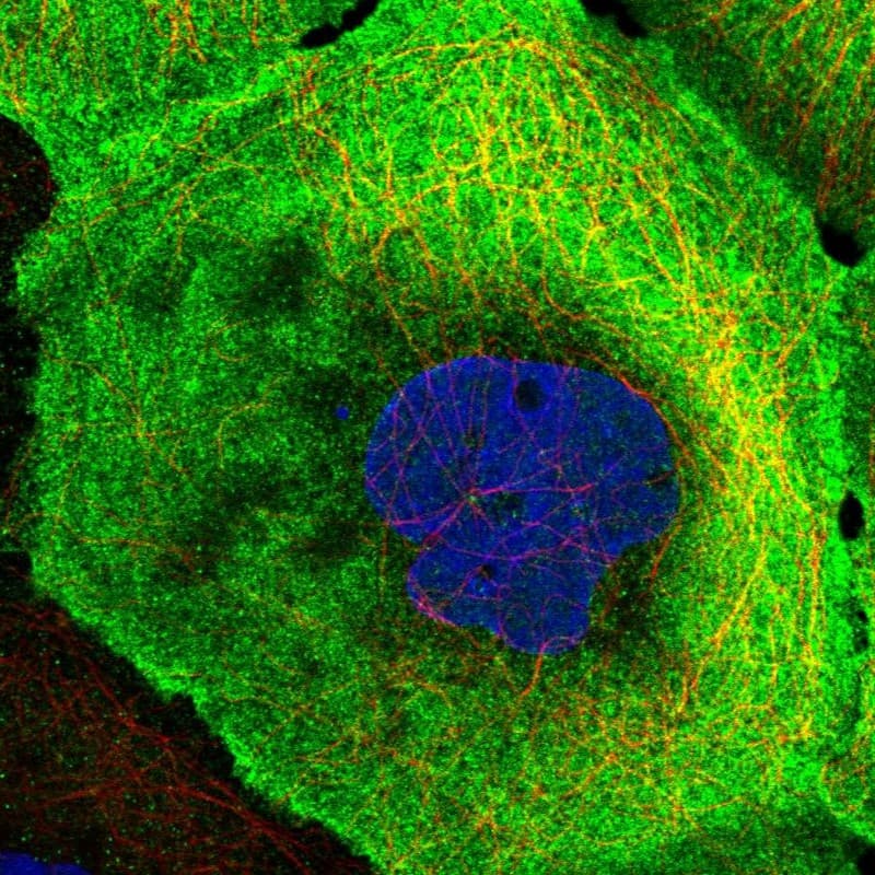 Staining of human cell line A-431 shows localization to plasma membrane & cytosol.