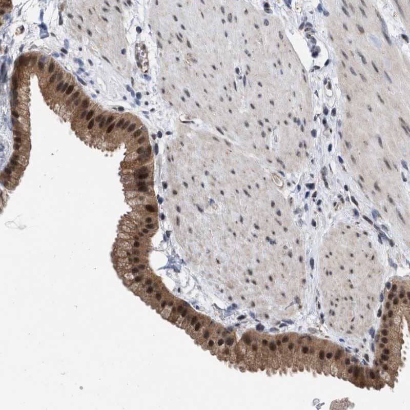 Staining of human gall bladder shows moderate cytoplasmic and nuclear positivity in glandular cells.