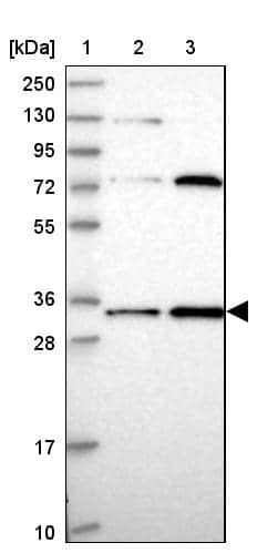 Lane 1: Marker [kDa] 250, 130, 95, 72, 55, 36, 28, 17, 10Lane 2: Human cell line RT-4Lane 3: Human cell line U-251MG sp
