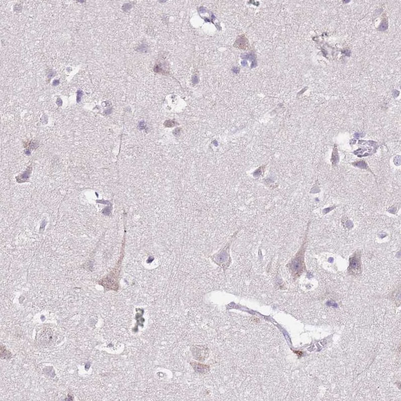 Staining of human cerebral cortex shows weak granular cytoplasmic positivity in neurons.