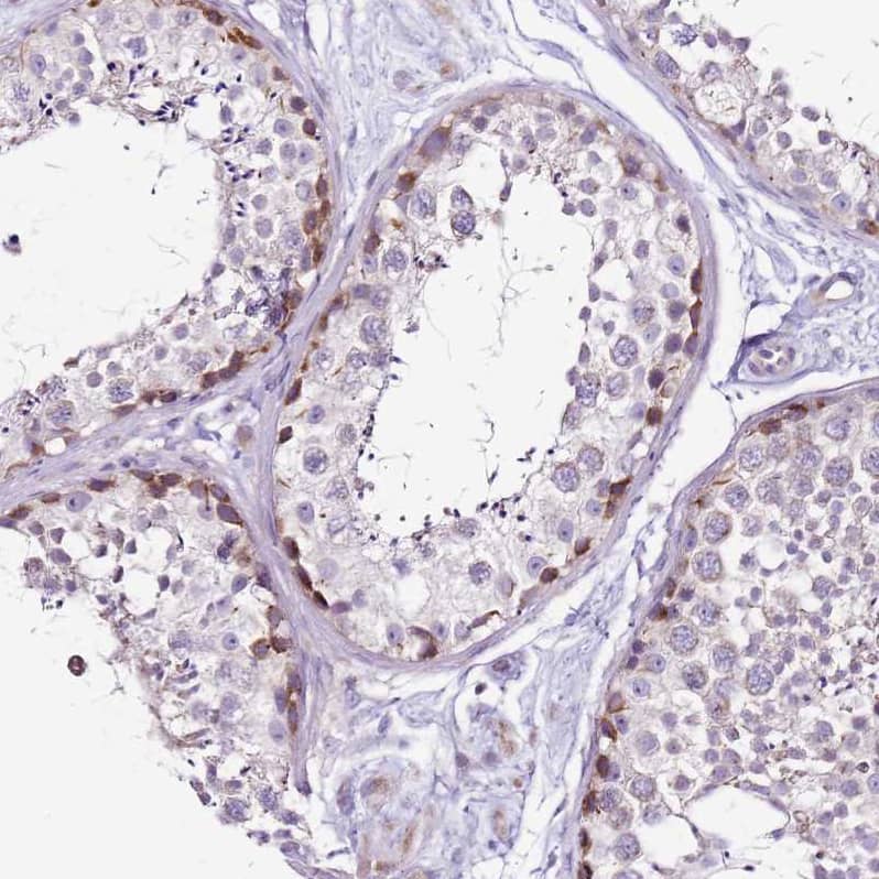 Staining of human testis shows moderate granular cytoplasmic positivity in subset of cells in seminiferous ducts.