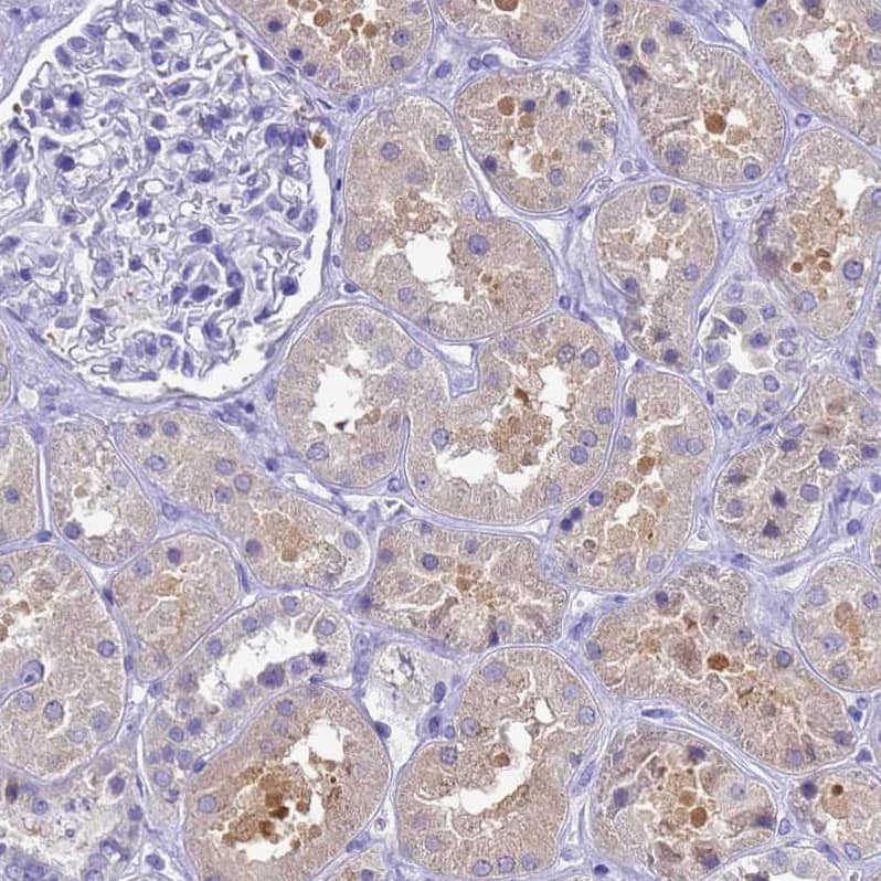 Staining of human kidney weak cytoplasmic positivity in cells in tubules.