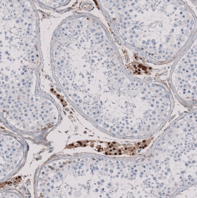 Staining of human testis shows strong nuclear positivity in Leydig cells.
