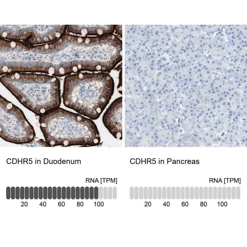 Analysis in human duodenum and pancreas tissues using NBP1-92149 antibody. Corresponding CDHR5 RNA-seq data are presented for the same tissues.