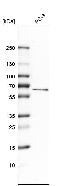 Analysis in human cell line PC-3.