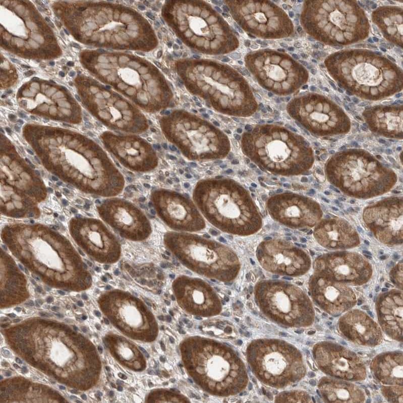 Staining of human stomach shows moderate cytoplasmic positivity in glandular cells.