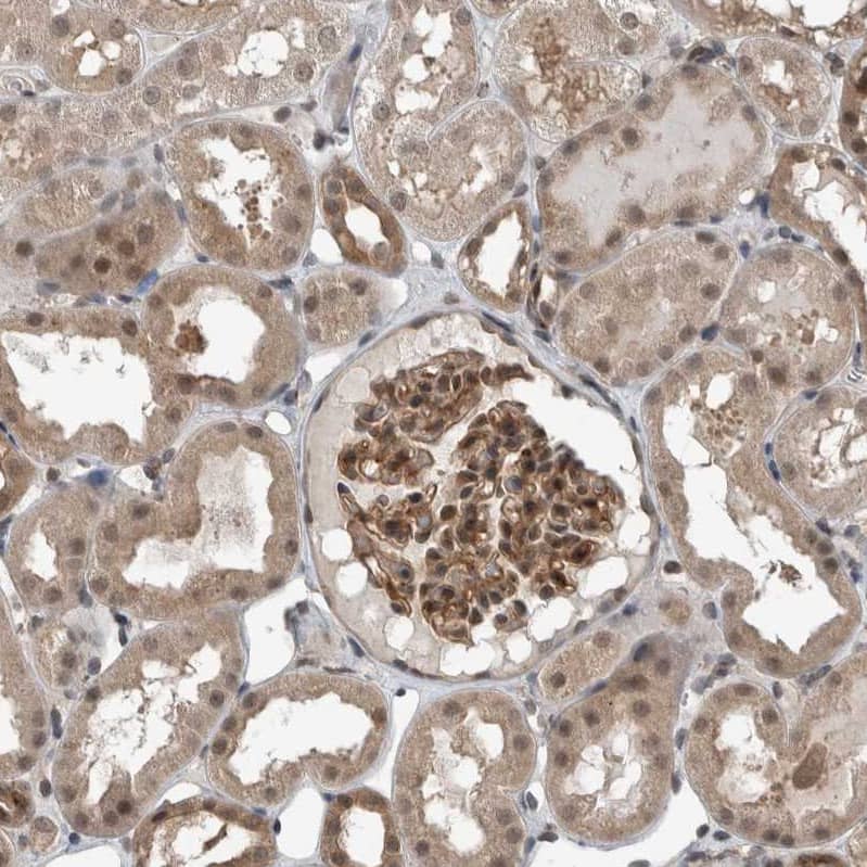 Staining of human kidney shows moderate cytoplasmic positivity in cells in glomeruli cells in tubules.