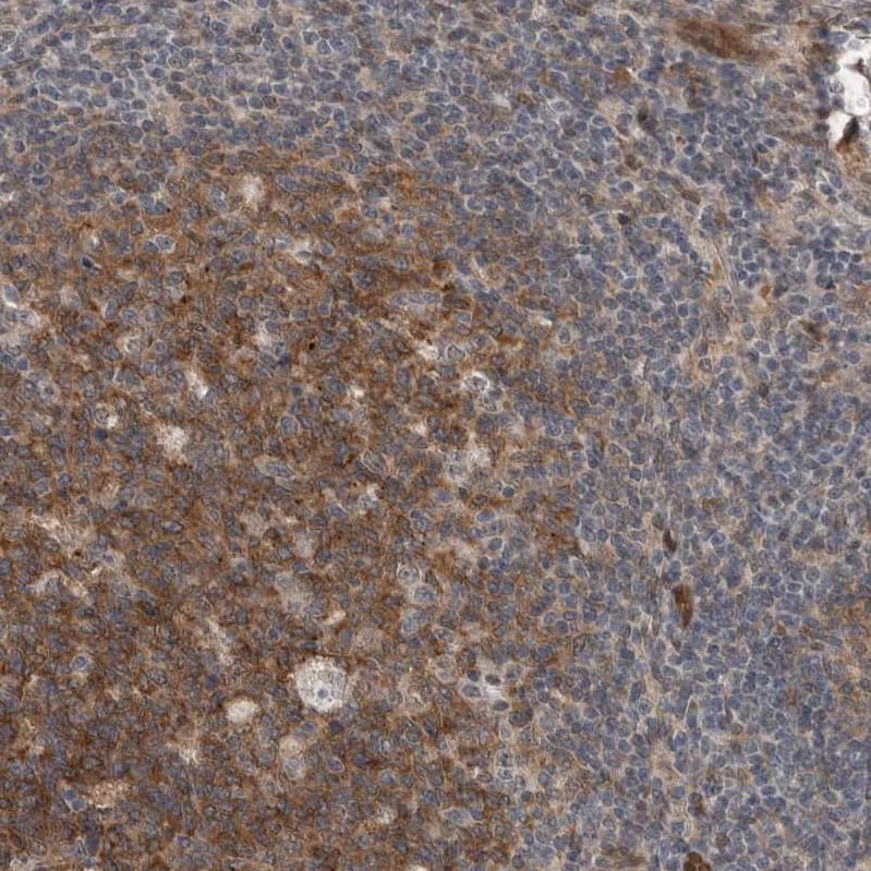 Staining of human lymph node shows moderate cytoplasmic positivity in germinal center cells.