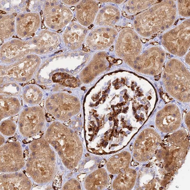 Staining of human kidney shows strong cytoplasmic positivity in cells in glomeruli.