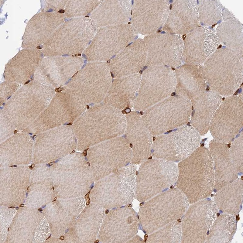 Staining of human skeletal muscle shows moderate cytoplasmic positivity in myocytes.