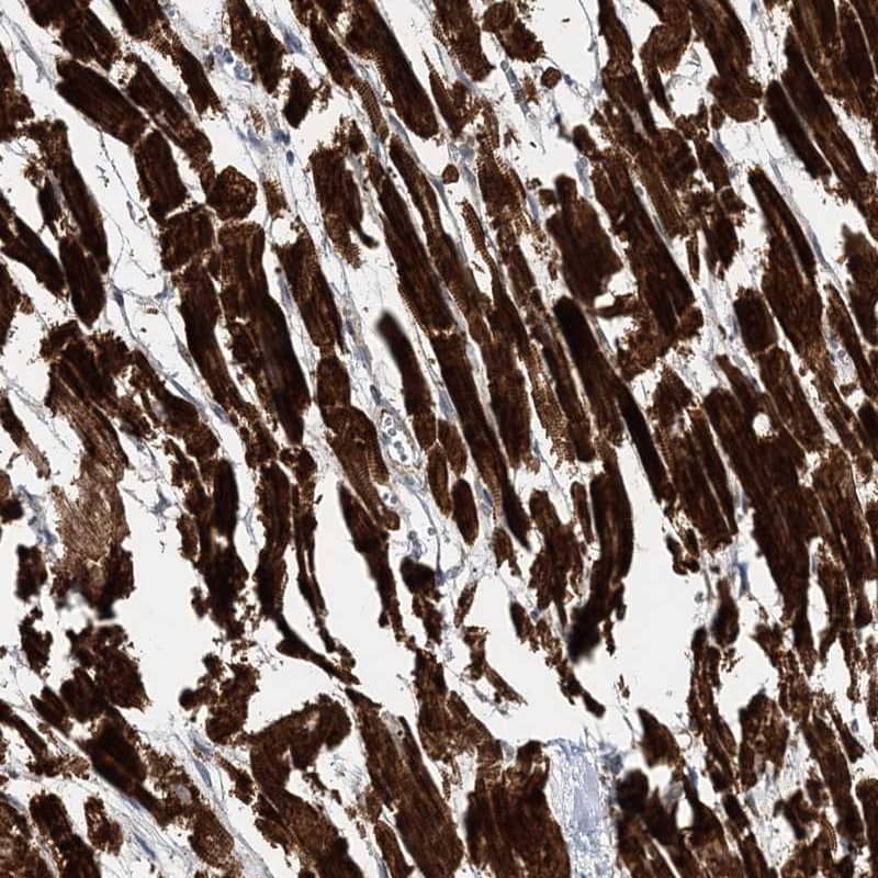 Staining of human heart muscle shows cytoplasmic positivity in myocytes.