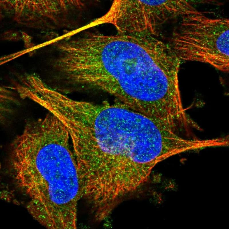 Staining of human cell line U-251 MG shows localization to cytosol.