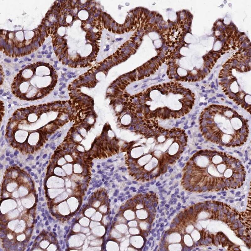 Staining of human colon shows strong cytoplasmic positivity in glandular cells.