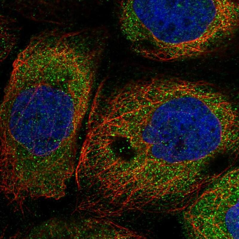 Staining of human cell line A-431 shows localization to cytosol.