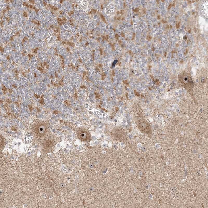 Staining of human cerebellum shows strong nucleolar positivity in Purkinje cells.