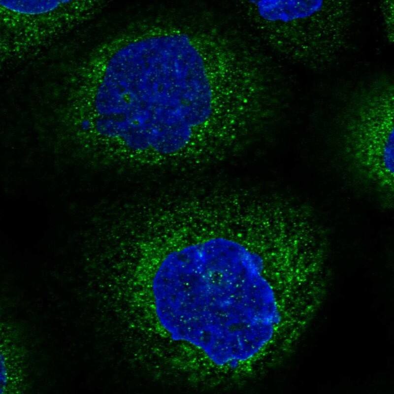 Staining of human cell line A-431 shows localization to endoplasmic reticulum.