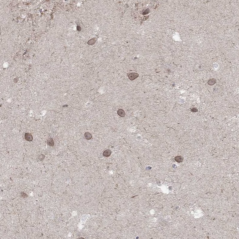 Staining of human hippocampus shows moderate nuclear membraneous positivity in neurons.
