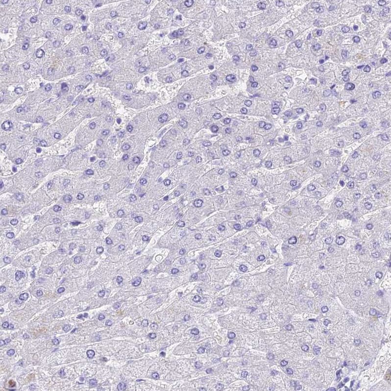 Staining of human Liver shows no positivity in hepatocytes as expected.
