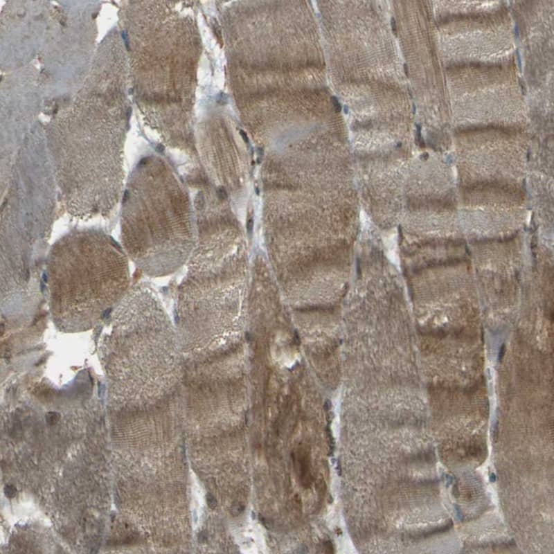 Staining of human skeletal muscle shows moderate cytoplasmic positivity in myocytes.