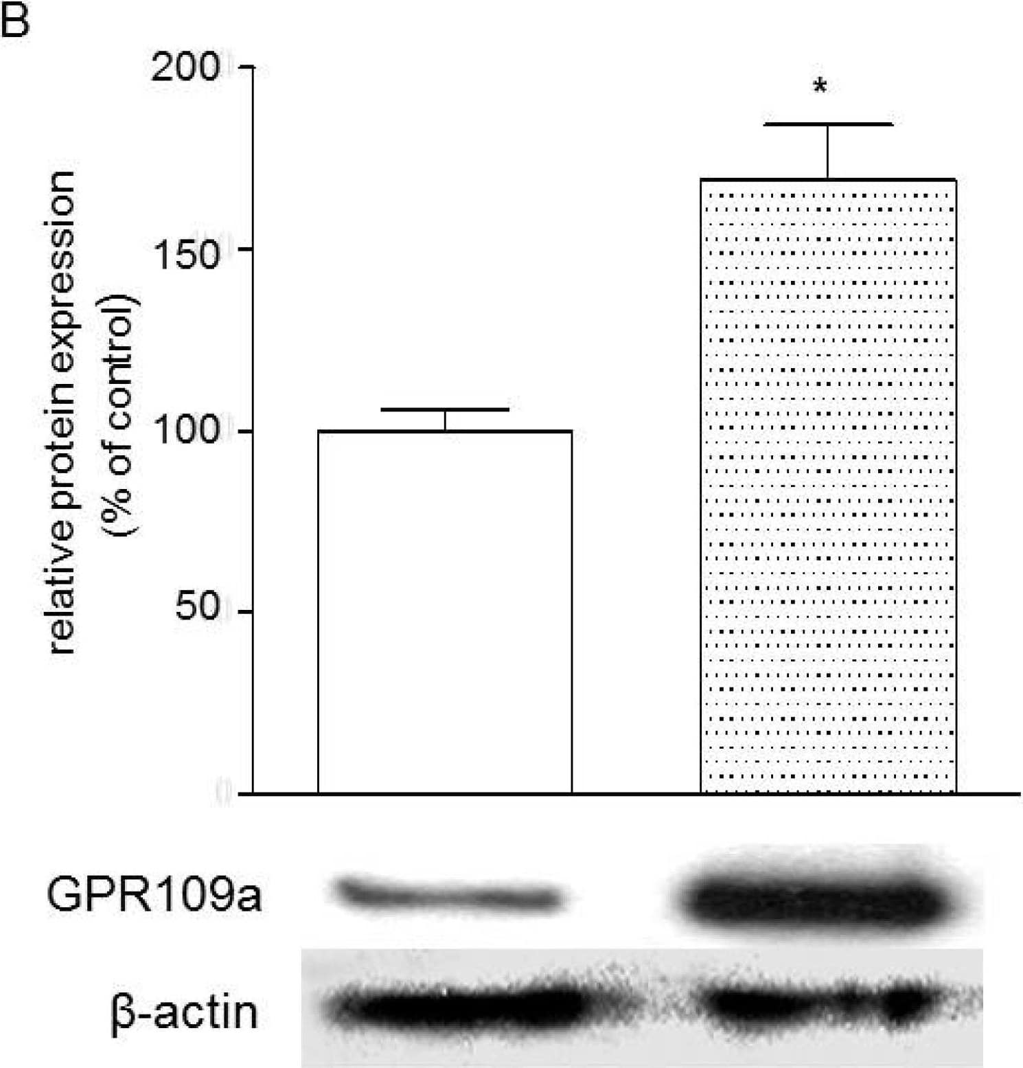 Western Blot HM74A/PUMA-G/GPR109A/NIACR1 Antibody - BSA Free