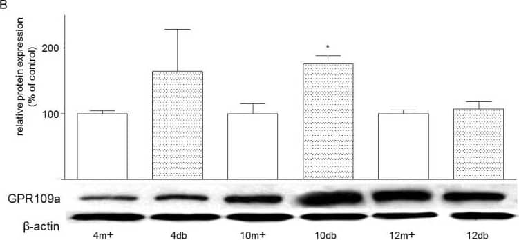 Western Blot HM74A/PUMA-G/GPR109A/NIACR1 Antibody - BSA Free